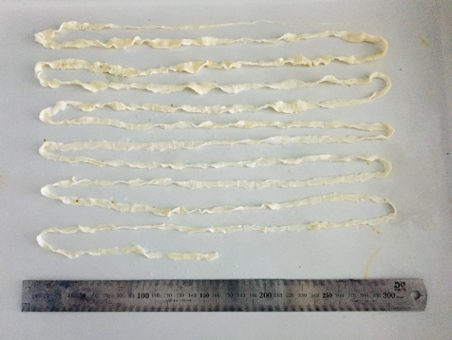 吃这种肉小心！体内可能长出 4 米长虫！预防方法大公开