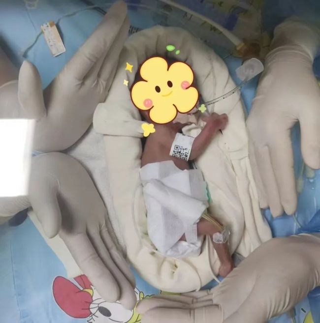 海口创纪录：455克迷你宝宝健康出院，刷新海南新生儿体重最小纪录